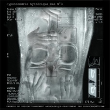 Cas N°3.15x15 .jpg