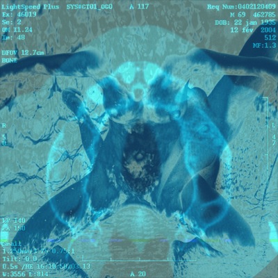 Loading Image
