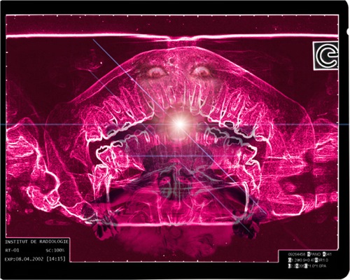 Loading Image