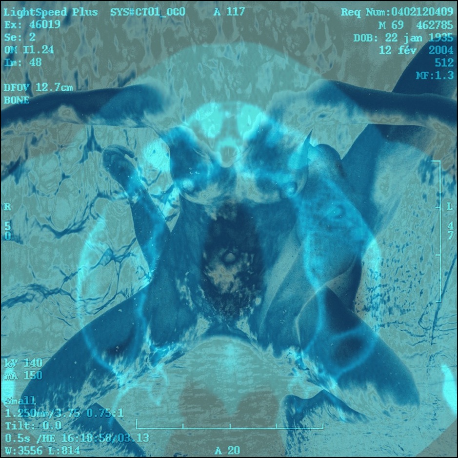 Cas N°10 30x40
