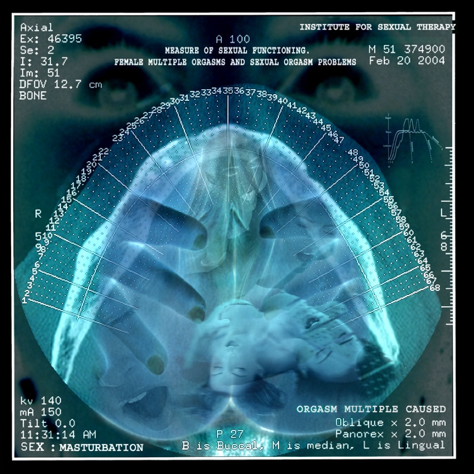 Cas N°5.30x30