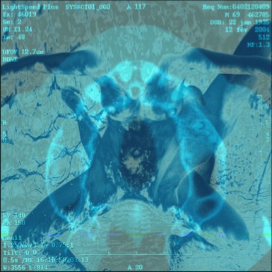 Cas N°10